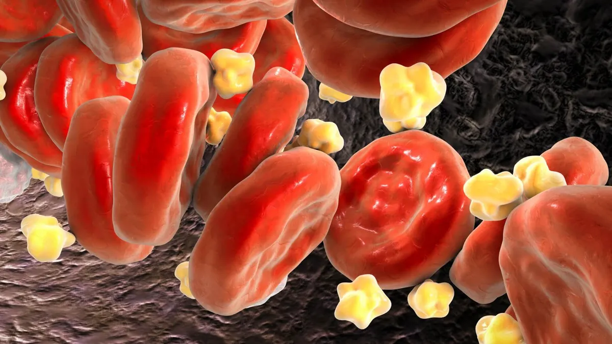 Trait: Blood Fat Level (APOA5)