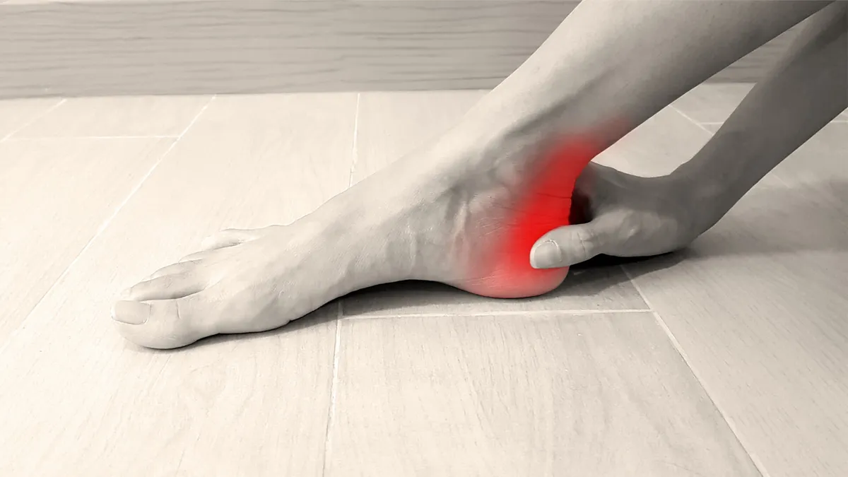 Trait: Musculoskeletal soft tissue injury risk (COL5A1)