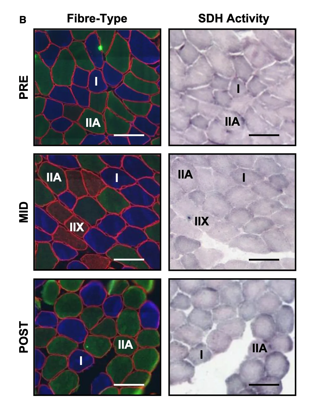 Panel B showing paired muscle cross-section images at three time points (PRE, MID, POST), with fiber-type immunofluorescence on the left and succinate dehydrogenase (SDH) activity staining on the right. Each image includes a scale bar. Fiber-type column (fluorescence): Fibers are color-coded by type — blue for Type I (slow), green for Type IIA, and red/intermediate for hybrid IIX fibers, with red borders outlining all fibers. At PRE, the section shows a mix of blue Type I and green Type IIA fibers with no visible IIX. At MID, red-staining IIX hybrid fibers appear prominently alongside Type I and IIA. At POST, IIX fibers are absent and the section is dominated by blue Type I and green Type IIA fibers, with fibers appearing larger in cross-sectional area than at PRE. SDH activity column (light microscopy): SDH staining reflects mitochondrial oxidative capacity — darker staining indicates higher activity. At PRE, Type I fibers stain darker than Type IIA. At MID, IIX fibers are visibly pale (low SDH activity) compared to Type I and IIA. At POST, overall staining intensity appears more uniform, with fibers showing moderate-to-high SDH activity and no pale IIX fibers present. Together the panels illustrate a training-induced fiber type transition: IIX fibers emerge transiently at MID before converting predominantly to IIA by POST, accompanied by changes in oxidative capacity.