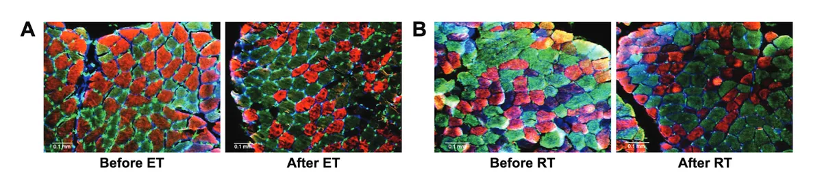 Fluorescence microscopy images of muscle cross-sections showing fiber type composition before and after two training interventions, with a 0.1 mm scale bar in each panel. Panel A (Endurance Training, ET): Before ET, muscle fibers are predominantly red (Type I slow-twitch) with some green (Type IIa fast-twitch) fibers and blue connective tissue borders. After ET, the proportion of green fibers increases relative to red, suggesting a shift in fiber type distribution. Panel B (Resistance Training, RT): Before RT, fibers display a mixed color pattern of red, green, and blue, indicating a heterogeneous fiber type composition including hybrid fibers. After RT, the section shows a shift toward more green and blue fibers, with fewer purely red fibers visible, and fibers appear larger in cross-sectional area.